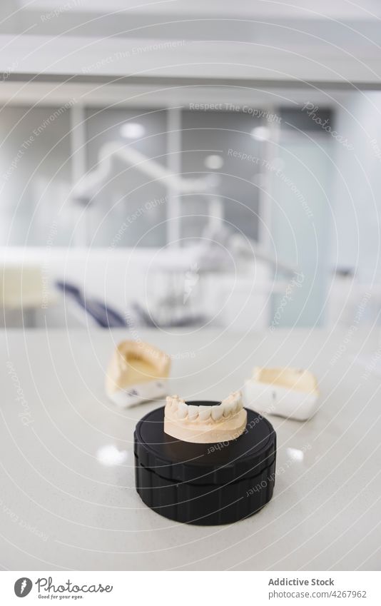 Kieferabdrücke auf dem Tisch in einem modernen Krankenhaus gießen kieferorthopädisch Zähne medizinisch mündlich dental künstlich Klinik Gips Fälschung verputzen