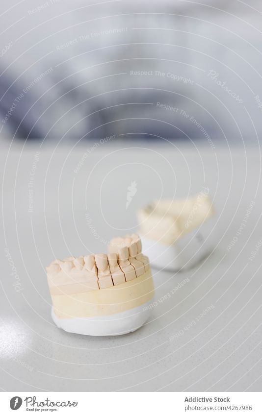 Gipsabdrücke des Kiefers auf dem Tisch in der Klinik gießen Zähne kieferorthopädisch medizinisch Fälschung verputzen professionell Ober... dental mündlich