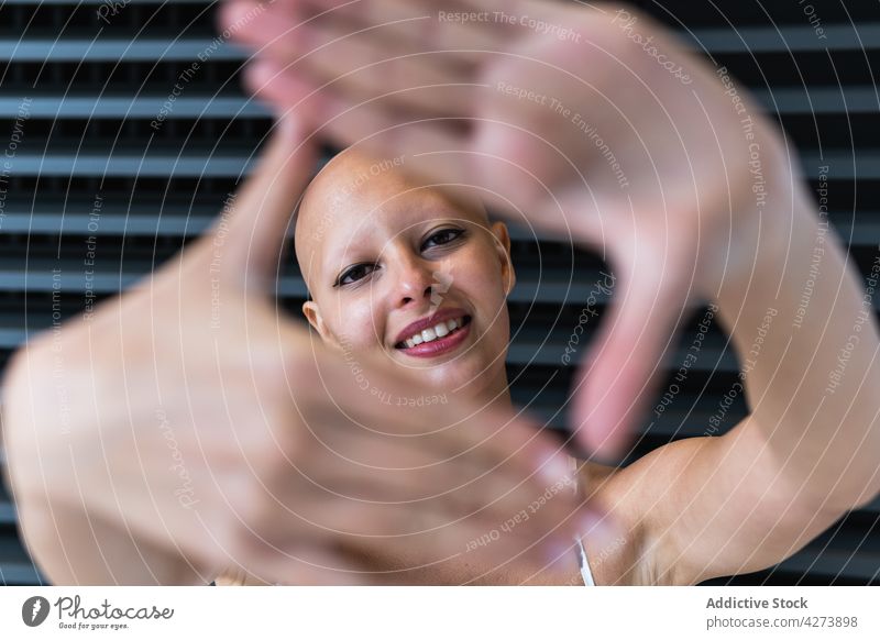Positive junge Frau mit Glatze zeigt in die Kamera und lächelt gestikulieren Lächeln positiv Alopezie kahl trendy Individualität Freude Stil froh Straße Outfit
