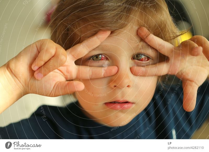 Kind mit roten Augen schaut in die Kamera rote Augen Krankheit Konjunktivitis Chirurgie ernst Behandlung Lebererkrankung Ursache Gesundheitswesen