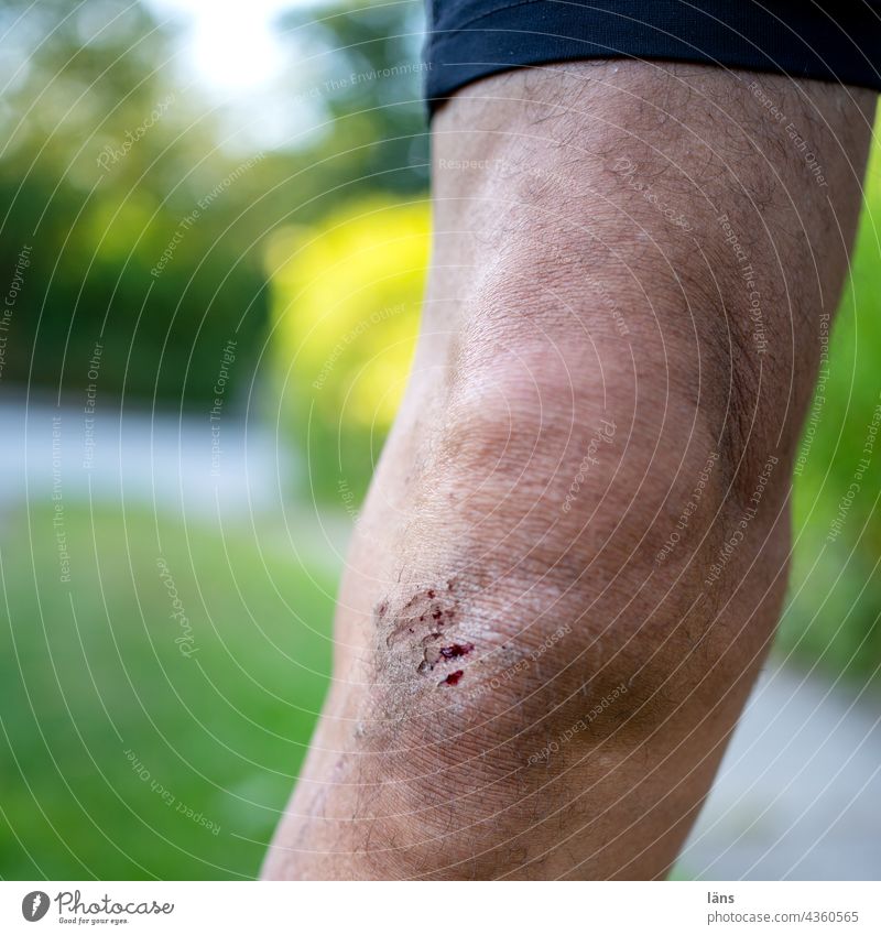Aua… Schürfwunde am Knie Mensch Haut Wunde Schmerz Bein Farbfoto wehtun Unfall Sturz Blut Zerkratzt