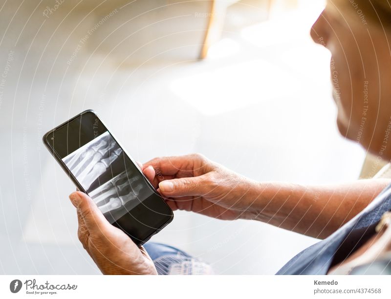 Alte Frau betrachtet ihr Röntgenbild auf dem Handy zu Hause, Online-Arzt Konzept. Kopierraum oben. röntgen medizinisch alt Holunderbusch gealtert Medizin online
