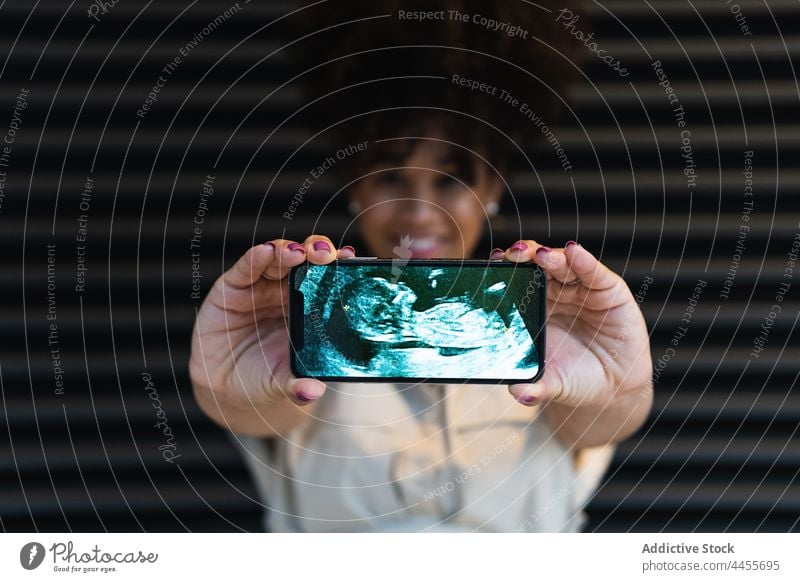 Lächelnde schwarze Frau zeigt Smartphone-Bildschirm mit Baby-Ultraschall schwanger benutzend Glück zeigen erwarten Bauch Schwangerschaft Funktelefon mütterlich