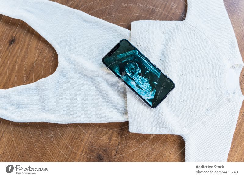 Smartphone mit Ultraschall-Babybild auf Kinderoutfit Bild Schwangerschaft Konzept mütterlich vorwegnehmen erwarten Outfit Mutterschaft Mobile Bildschirm