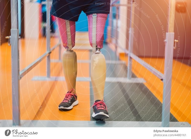 Nahaufnahme einer Frau mit Beinprothese am Barren Physiotherapie Tatkraft Wiederherstellung Rehabilitation Stärke Training Beine Übung Fitness Sport Gesundheit