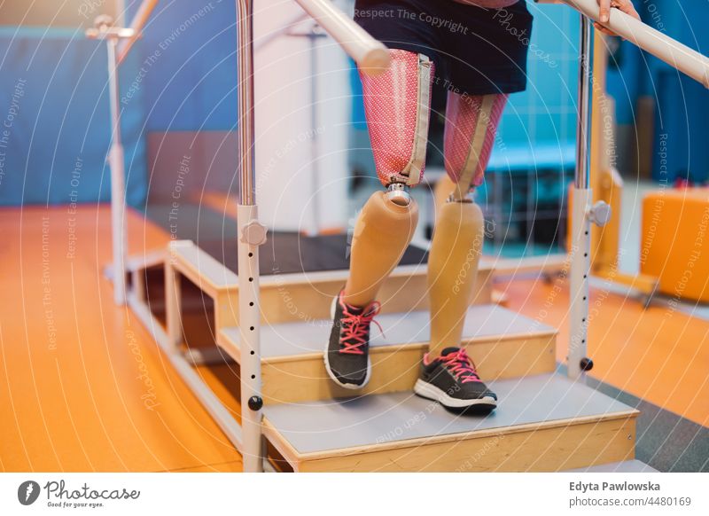 Nahaufnahme einer jungen Frau mit Beinprothese in einem Physiotherapiezentrum Tatkraft Wiederherstellung Rehabilitation Stärke Training Beine Übung Fitness
