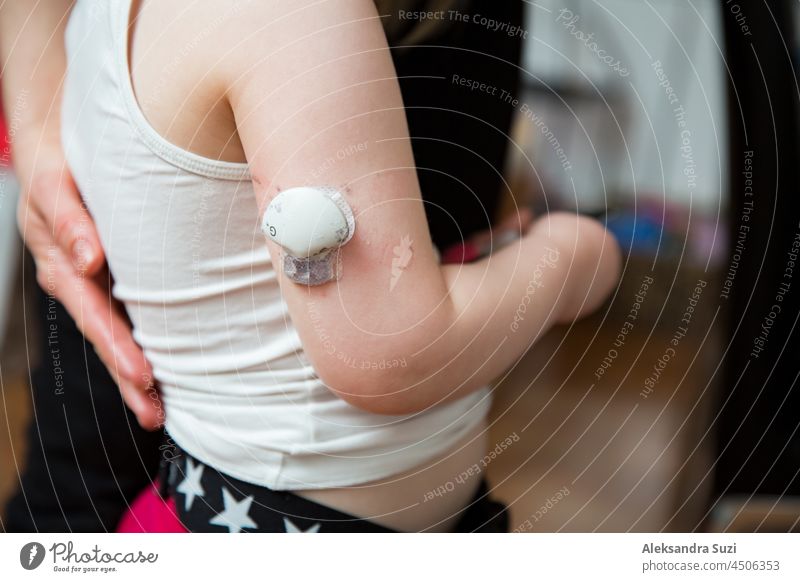 Kleines Kind mit dem Diabetessensor des Glukoseüberwachungssystems am Arm. Diabetes-Behandlung für Kinder Baby Abtastung Sensor Diabetiker Klebstoff Arme Blut