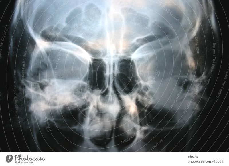 Roentgen Kopf 2 schwarz weiß Fototechnik Schädel Radiologie
