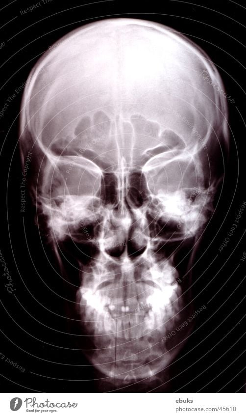 Roentgen Kopf 1 schwarz weiß Skelett Fototechnik Schädel Radiologie