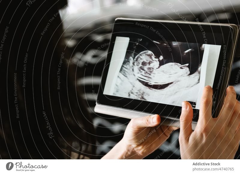 Anonyme schwangere Frau schaut sich Babyfotos auf dem Tablet an Scan Foto Tablette ungeboren Ultraschall Mutter Schwangerschaft heiter Glück erwarten