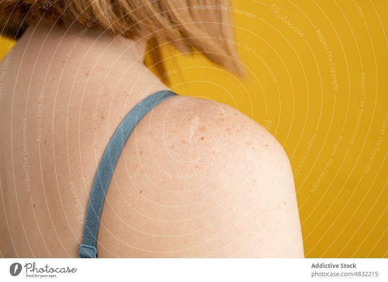 Gesichtslose Dame mit Sommersprossen auf der Schulter in einem gelben Studio Frau nackte Schultern feminin körperpositiv Model Pigment Individualität Anmut