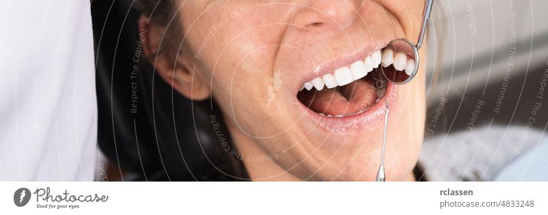 Zähne Gesundheit Konzept. Cropped Foto von lächelnden Frau Mund unter Behandlung in der Zahnklinik, Banner Größe dental Zahnarzt Zahnmedizin Pflege Lächeln
