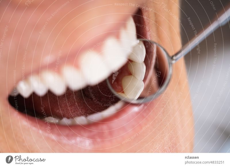 Schöne Frau lächeln. Zahnmedizinische Versorgung Klinik Konzept Bild dental Zahnarzt Pflege Gesundheit Lächeln weiße Zähne Arzt geduldig Spiegel Mundhygiene