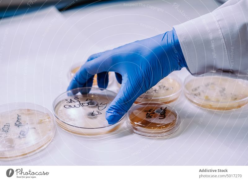 Frau arbeitet mit Petrischalen im Labor Agar Technik & Technologie Infektion Kolonie Techniker Wissenschaftler Handschuh Probe Keime Pilze Medien schützend