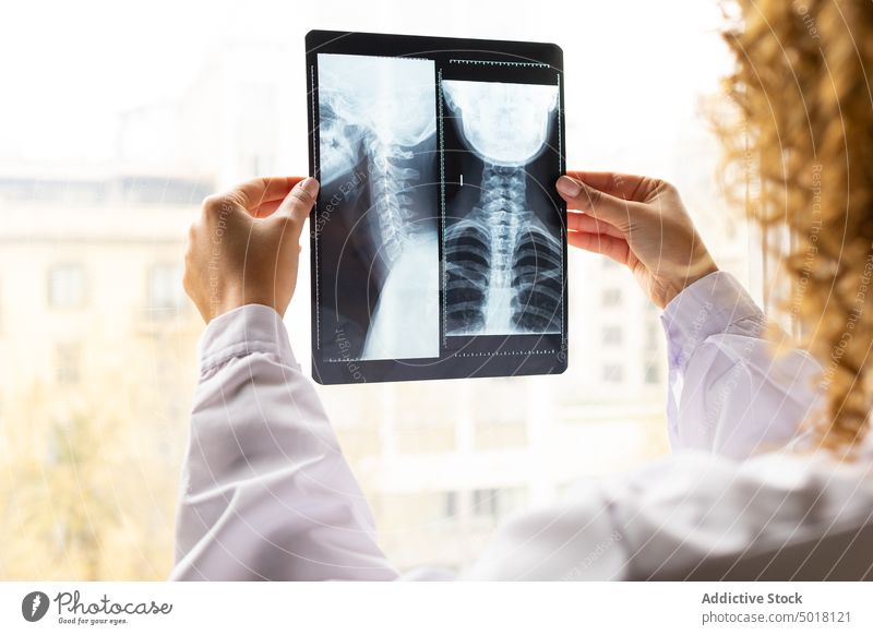 Anonymer ethnischer Arzt bei der Analyse eines Röntgenbildes der Wirbelsäule in einer Klinik analysieren Bild Rückgrat Röntgenaufnahme achtsam Frau Büro Porträt