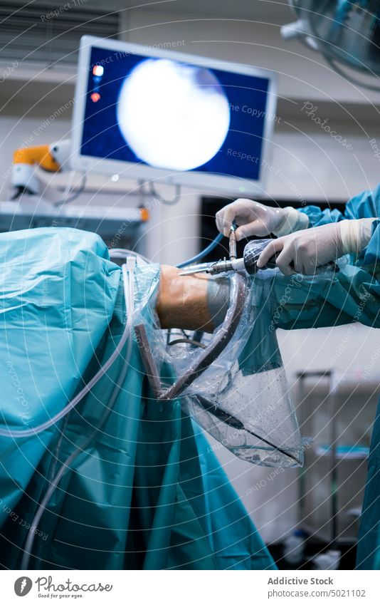 Chirurg führt Operation durch das Knie durch Hände einstecken geduldig Endoskop Operationssaal Gerät Medizin Arzt Mann Krankenhaus Raum Gesundheitswesen