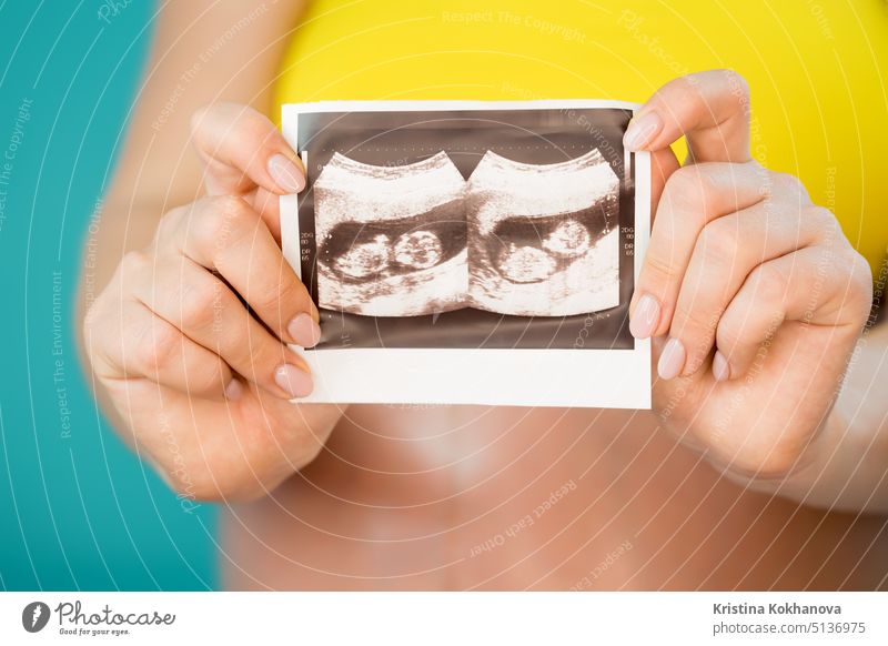 Close-up von unerkennbar schwangere Frau hält Ultraschall-Scan auf ihren Bauch Hintergrund. Mutterschaft, Mutterschaft, Schwangerschaft, Liebe, Zwillinge Konzept.