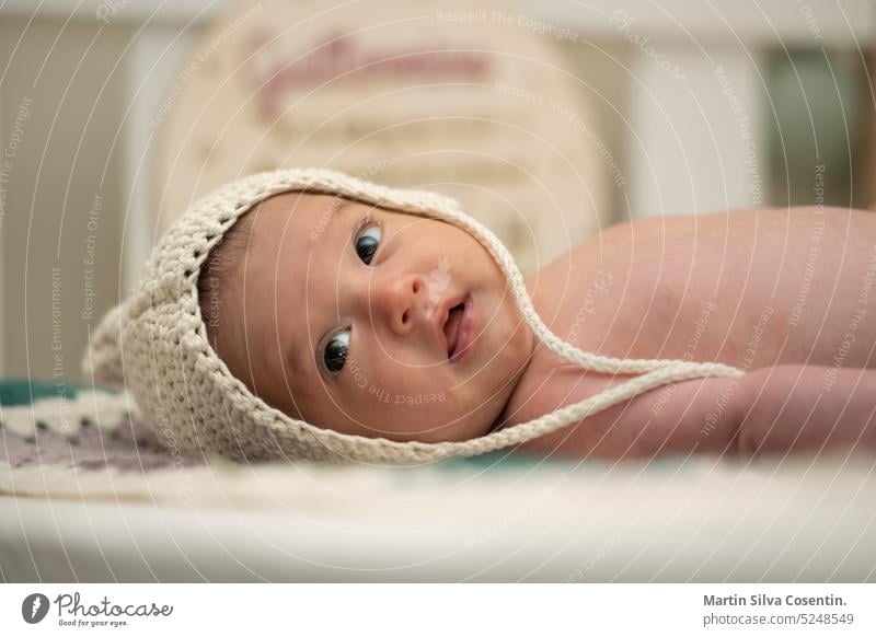 Baby mit zwei Lebensmonaten in seiner Krippe mit Wollmütze Allergie asiatisch schön Schönheit Körper Junge atmungsaktiv Kaukasier Kindheit Dermatitis
