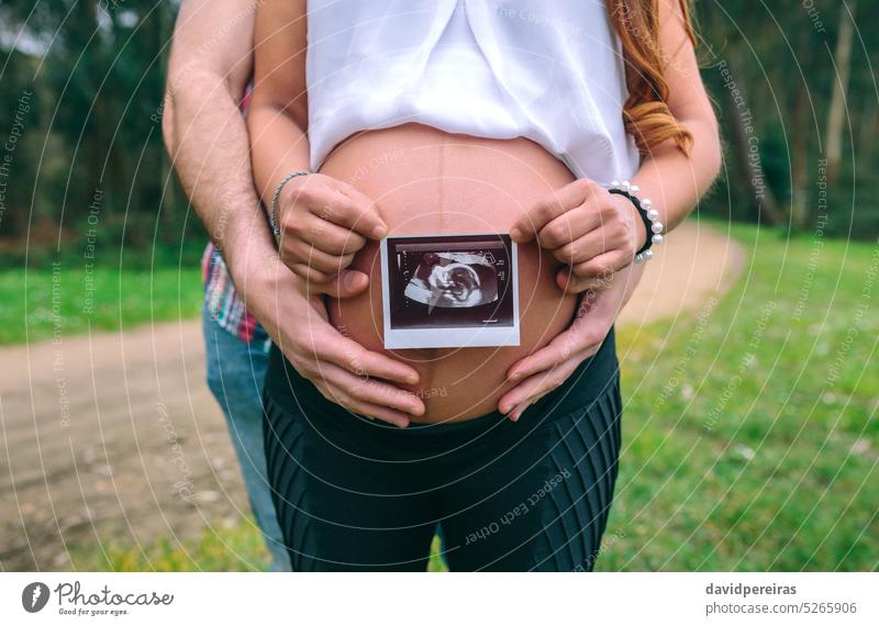 Schwangere Frau zeigt Ultraschallbild des Babys, während ihr Partner ihren Bauch hält unkenntlich schwanger Paar Scan Echographie Schwangerschaft Fötus Latein