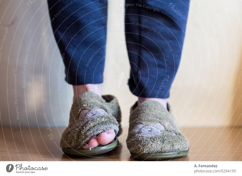 Detail der Füße eines Kindes, das alte, kaputte und abgenutzte Hausschuhe trägt, aus denen die Zehen herausragen. Armut Konzept Pantoffel Hauspantoffeln