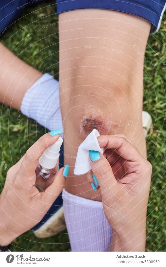 Eine Frau trägt Desinfektionsmittel auf eine Verletzung auf bewerben Knie Gesundheitswesen behüten Training Wiederherstellung Schmerz liquide Leckerbissen
