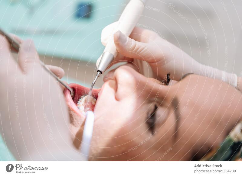 Crop-Zahnarzt bei der Behandlung der Zähne eines Patienten im Krankenhaus geduldig Klammer Werkzeug Leckerbissen mündlich dental Verfahren Zahnmedizin Ernennung