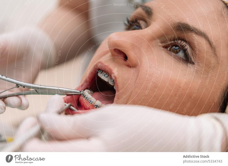 Zahnarzt setzt Zahnspange auf die Zähne einer Frau geduldig Klammer Werkzeug Leckerbissen angezogen Verfahren mündlich Handschuh Klinik dental Stomatologie