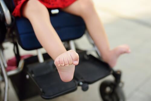 Behindertes Mädchen sitzt im Rollstuhl. Nahaufnahme der spastischen Muskeln ihrer Beine. Kind zerebrale Lähmung. Behinderung. Inklusion. deaktiviert