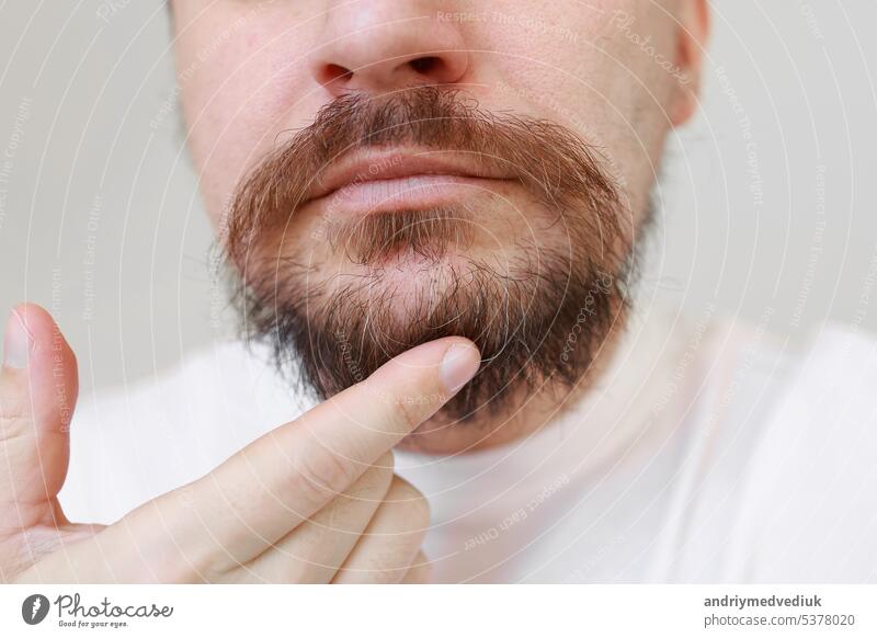 Ausgeschnittenes Foto eines bärtigen Mannes zeigt erste graue Haare auf dem überwucherten struppigen Bart und der Mähne. Melaninverlust in jungen Jahren, Ursachen: genetische Veranlagung, hormonelle Störungen, Störungen des endokrinen Systems