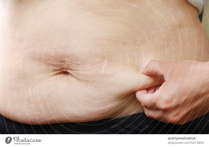 Close up von Mutter womans Bauch zeigt Dehnungsstreifen lose Unterbauch Haut sie Fett nach der Schwangerschaft Baby Geburt, Studio isoliert auf weißem Hintergrund, Gesunder Bauch Übergewicht überschüssige Körper Konzept