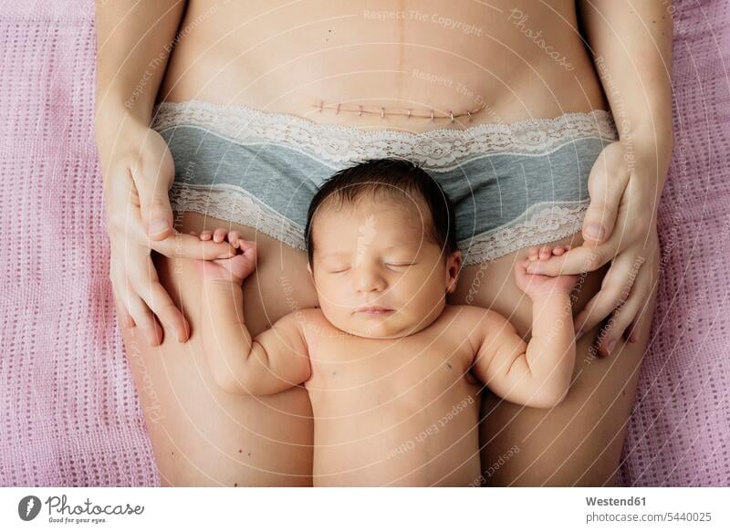 Neugeborenes Mädchen liegt auf den Oberschenkeln der Mutter in der Nähe einer frischen Kaiserschnittnarbe mit Klammern Kind Babies Babys Kinder Mami Mutti