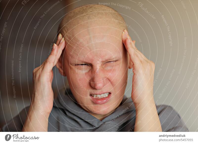 Glatzköpfige verärgerte Frau, die den Kopf mit den Fingern berührt, leidet unter Kopfschmerzen nach der Chemotherapie. Unglückliche wütende haarlose krebskranke Frau schreit, Migräne. Onkologie Konzept