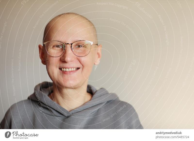 Lächelnde kahle Frau mit Brille kämpft mit Onkologie Blick in die Kamera. Hairless Krebs kranken weiblichen Patienten nach der Chemotherapie verloren ihre Augenbrauen und Wimpern fühlen sich optimistisch der Erholung Remission