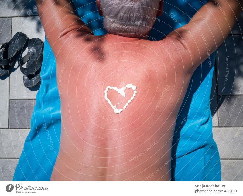 Ein Mann mit einem Sonnenbrand auf dem Rücken Rückansicht Sonnenmilch Ferien & Urlaub & Reisen Sommer Sonnenbad Erholung Sommerurlaub Schönes Wetter Sonnenlicht