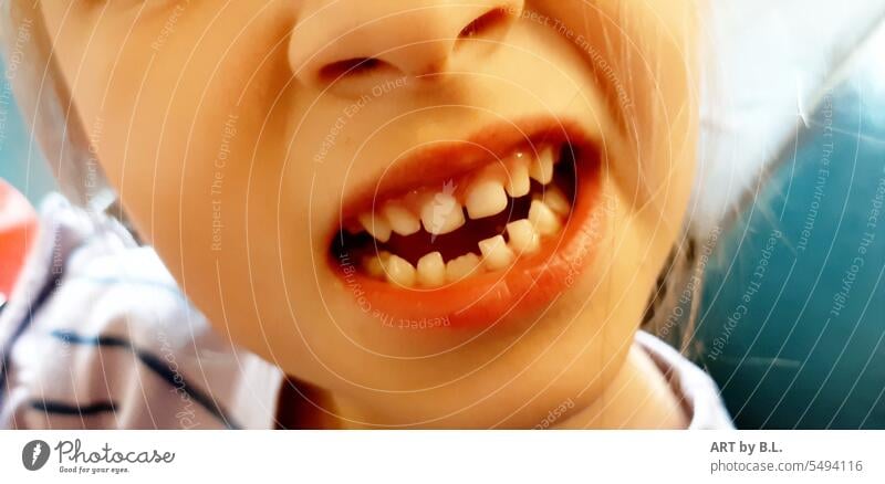 Wenn neue Zähne kommen zahn kind milchzahn mund wackelzahn zahnend nahaufnahme zahnarzt