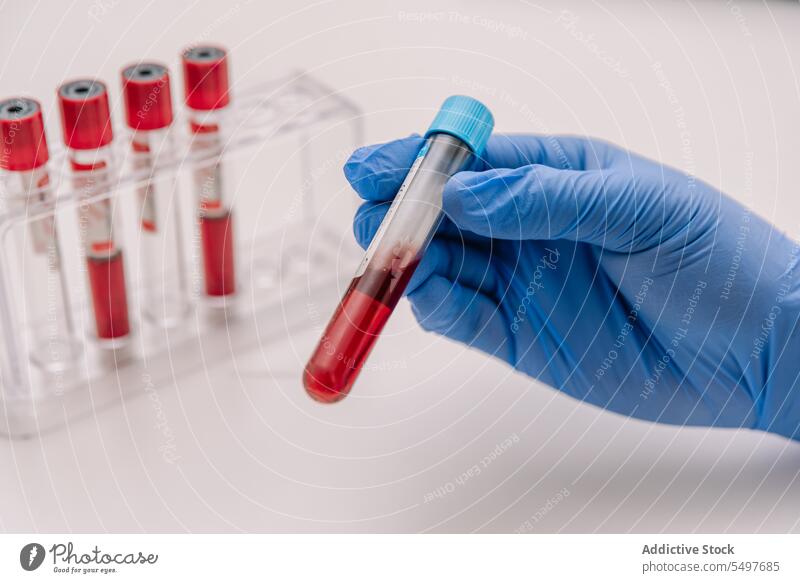 Crop-Arzt hält Blutprobenröhrchen im Labor Person Prüfung Reagenzglas Medizin medizinisch Probe Wissenschaft Hand Handschuh Zwischenablage Spezialist Analyse