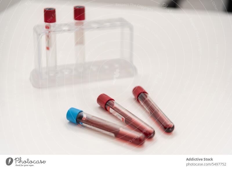 Satz Blutproben in Röhrchen auf dem Tisch Reagenzglas Labor Prüfung Probe Biochemie Diagnostik Ampulle Tube steril wissenschaftlich Analyse Kompetenz forschen