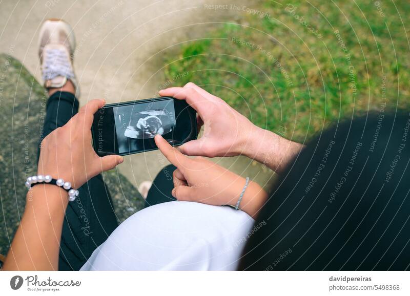Schwangere sucht Ultraschallbild am Telefon mit ihrem Paar unkenntlich schwanger Frau Partner Blick Scan Echographie Foto Mobile Zelle Smartphone