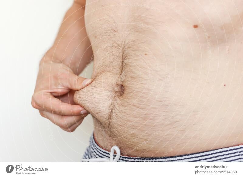 Cropped Foto des Mannes berührt seine nackte nicht fit Bauch Taille mit losen Haut leiden unter Übergewicht. Konzept der ungesunden Ernährung und Lebensstil, gesundheitliche Probleme von übergewichtigen Menschen.