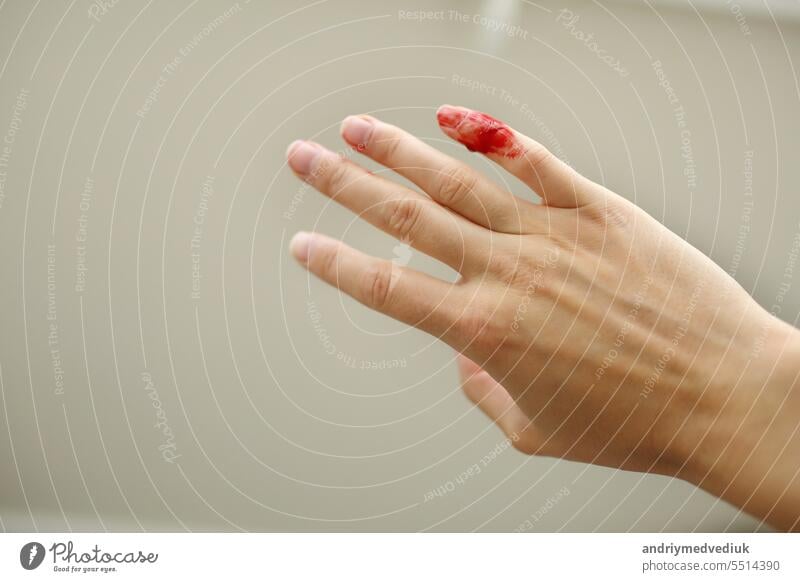 Weibliche Hand mit rotem Blut, der kleine Finger blutet stark. Die Frau hat ihren kleinen Finger zu Hause mit einem Messer oder einem anderen scharfen Gegenstand verletzt. Blutende Wunde und Körperverletzung sind die Folge. Häuslicher Unfall.
