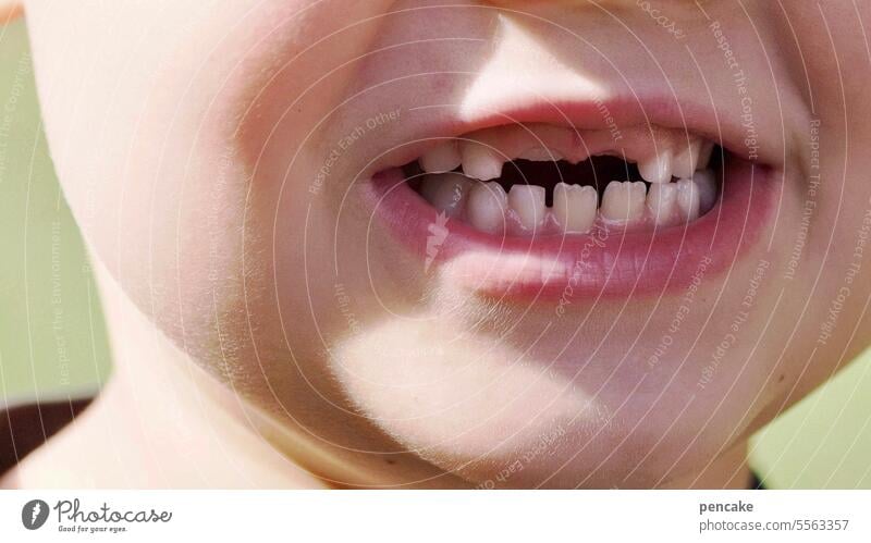 hilfreich | neue Zähne Zahnlücke Detailaufnahme Nahaufnahme kauen Kind Mund Entwicklung Gesundheit Milchzähne Junge lachen Mensch Kindheit Fröhlichkeit Wachstum