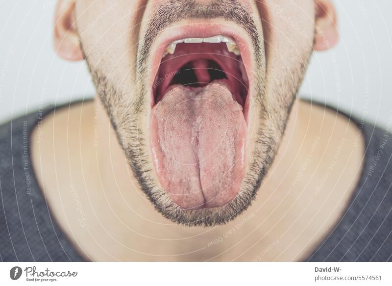 Mann streckt die Zunge raus zunge rausstrecken anonym Mundgeruch Arztbesuch Untersuchung zunge zeigen frech aaaah Gesichtsausdruck herrausgestreckt Nahaufnahme