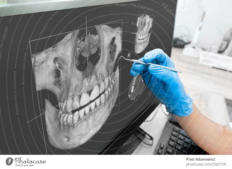 Arzt zeigt Zahnröntgenbild auf Computermonitor dental Zahnarzt panoramisch Kiefer Bildschirm Knochen Mund Radiologie Klinik Kopf Gesundheit menschlich mündlich