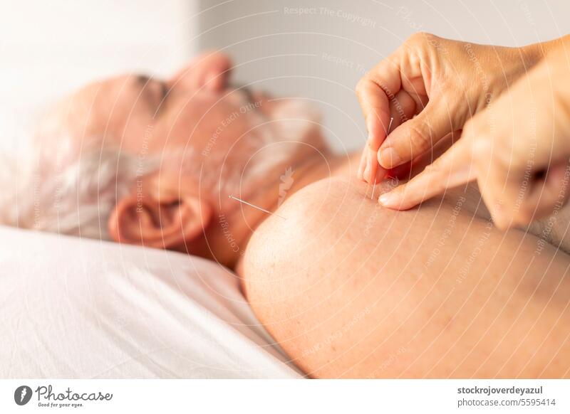 Die Hände eines Physiotherapeuten setzen Nadeln in die Schulter eines älteren Mannes während einer Akupunktursitzung in einer Physiotherapieklinik