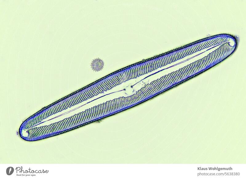 Kieselalge (Pinnularia? ) Negativ einer Dunkelfeldaufnahme. Mikroskopie struckturen und formen