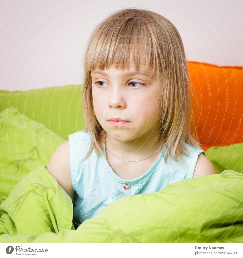 Porträt eines aufgebrachten 6-jährigen blonden Mädchens, das mit einem Windpockenausschlag im Gesicht in seinem Bett sitzt befallen Blister gelangweilt Kind