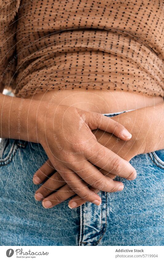 Detailaufnahme der zusammengefalteten Hände einer anonymen Person, von denen eine eine postoperative Anpassung zeigt, bei der die Daumen fehlen und die auf einer Jeans ruhen
