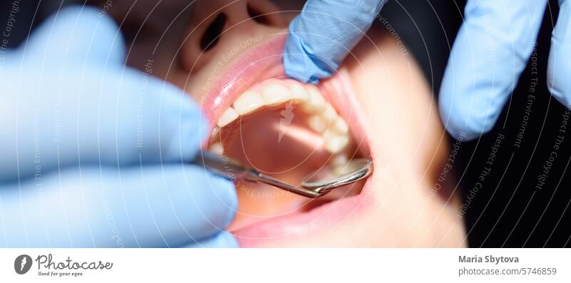 Zahnarzt behandelt die Zähne einer jungen Frau im Krankenhaus. Arzt Practitioner untersucht Patienten vor Kieferorthopäden oder prothetische Behandlung in modernen medizinischen Zentrum. Nahaufnahme von Zähnen und Händen. Banner
