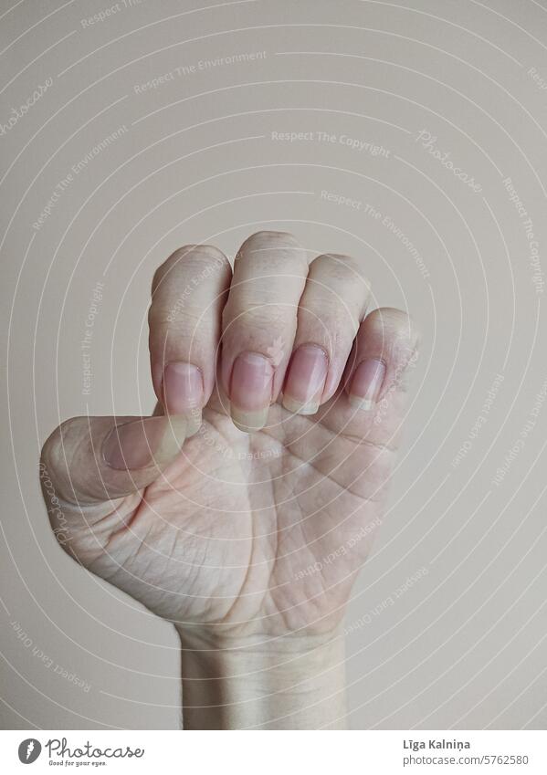 Nahaufnahme einer Hand mit unebenen Nägeln Frau Finger Hände freundlich Glück feminin lang