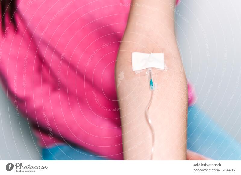 Eine Nahaufnahme des Arms eines Patienten mit einer sicher platzierten intravenösen Leitung, wobei das Klebeband eine minimale Bewegung für die ordnungsgemäße Verabreichung der Medikamente gewährleistet
